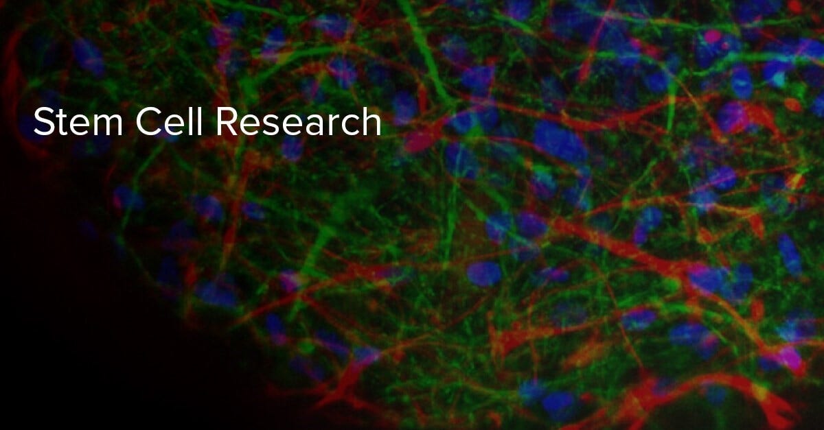 Europe Stem Cell Assay Market Size, Share, Report 2032