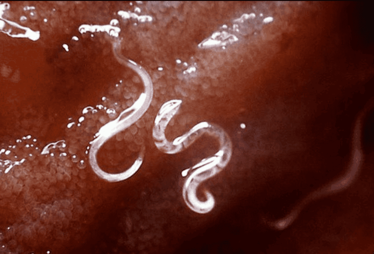 How do you get rid of harmful parasites and worms in your body?