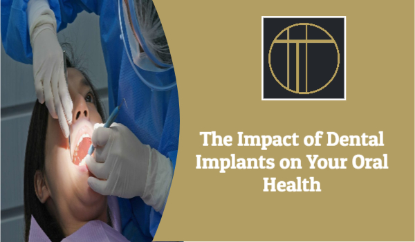 The Impact of Dental Implants on Your Oral Health