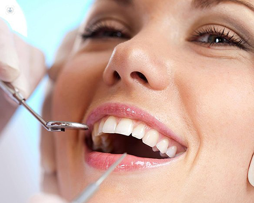 Revolutionizing Smiles: The Transformative Impact of Dental Implants in Tampa