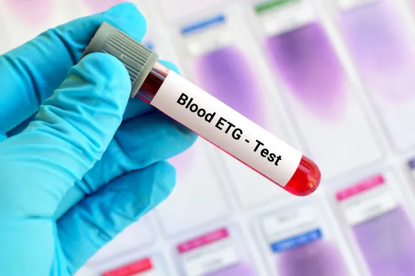 Different Types of Blood work Tampa FL Used for Disease Diagnosis