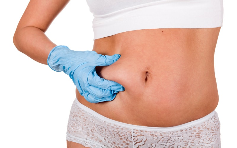 Liposuction Abu Dhabi: Contour Your Body Perfectly