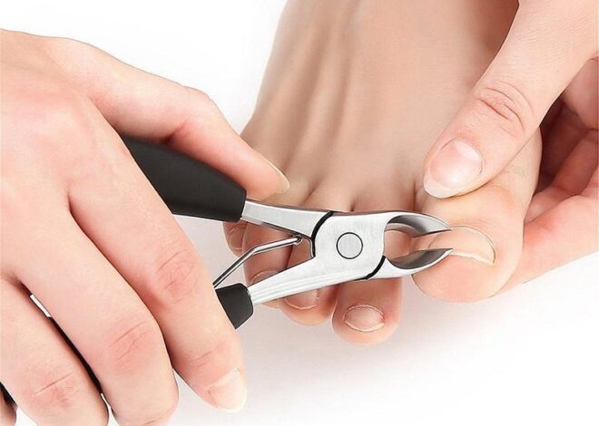 Nail Scissors for Ingrown Toenails A Step-by-Step Guide