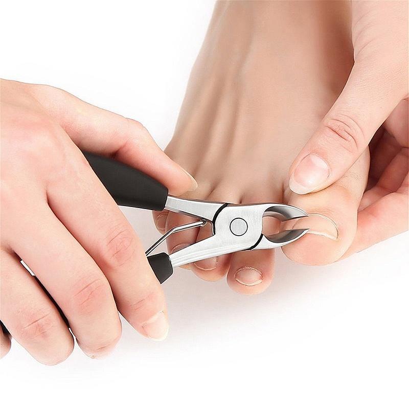 Nail Scissors for Ingrown Toenails A Step-by-Step Guide