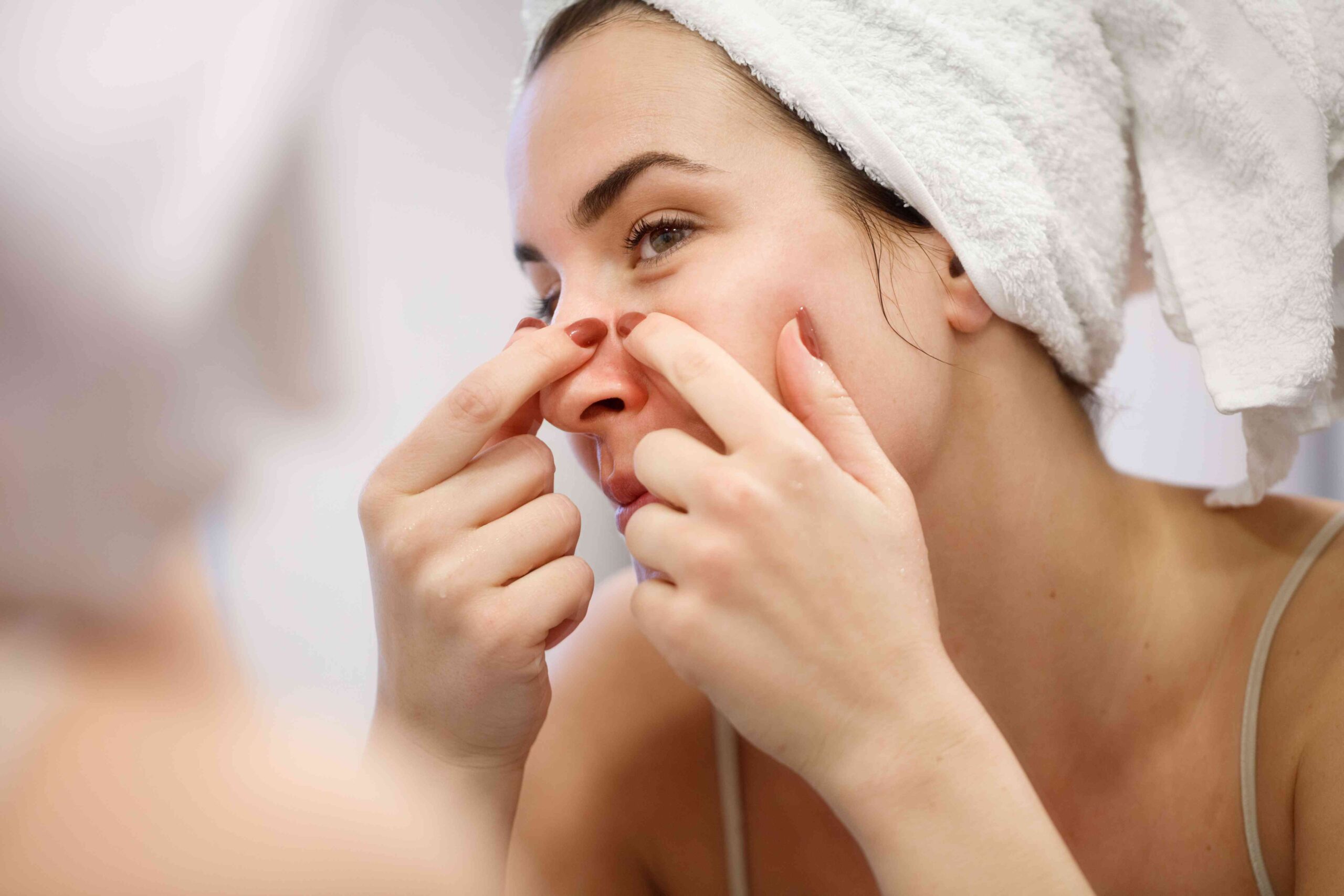 The best way to manage acne and stay acne-free