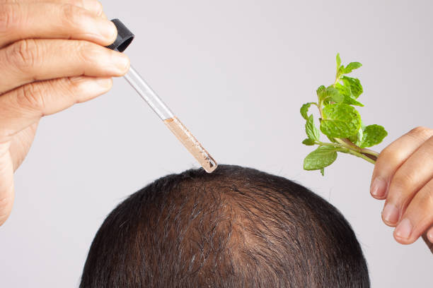 PRP Hair Treatment in Islamabad: A Safe, Effective Way to Fight Hair Loss