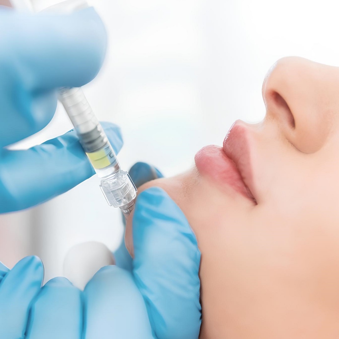 Reshape Your Look with Jawline Filler Injections